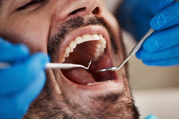 Best Same-Day Emergency Dentist in Bogata, TX