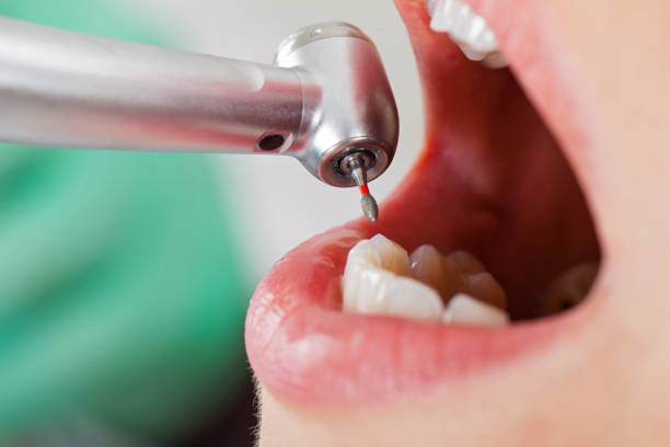 Best Pediatric Emergency Dentist in Bogata, TX